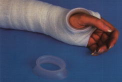 Orthopool Thumb Ring