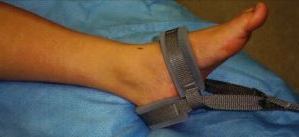 Orthopool Ankle Strap
